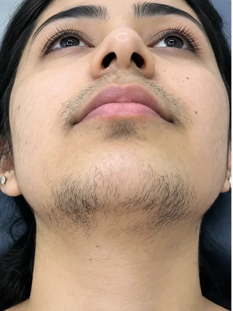 Before