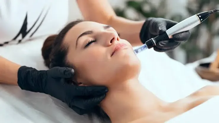 Microneedling Treatment in Johar Town Lahore | The Skin Care Studio