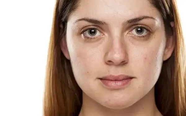 Dull & Tired-Looking Skin Treatment Near Johar Town Lahore
