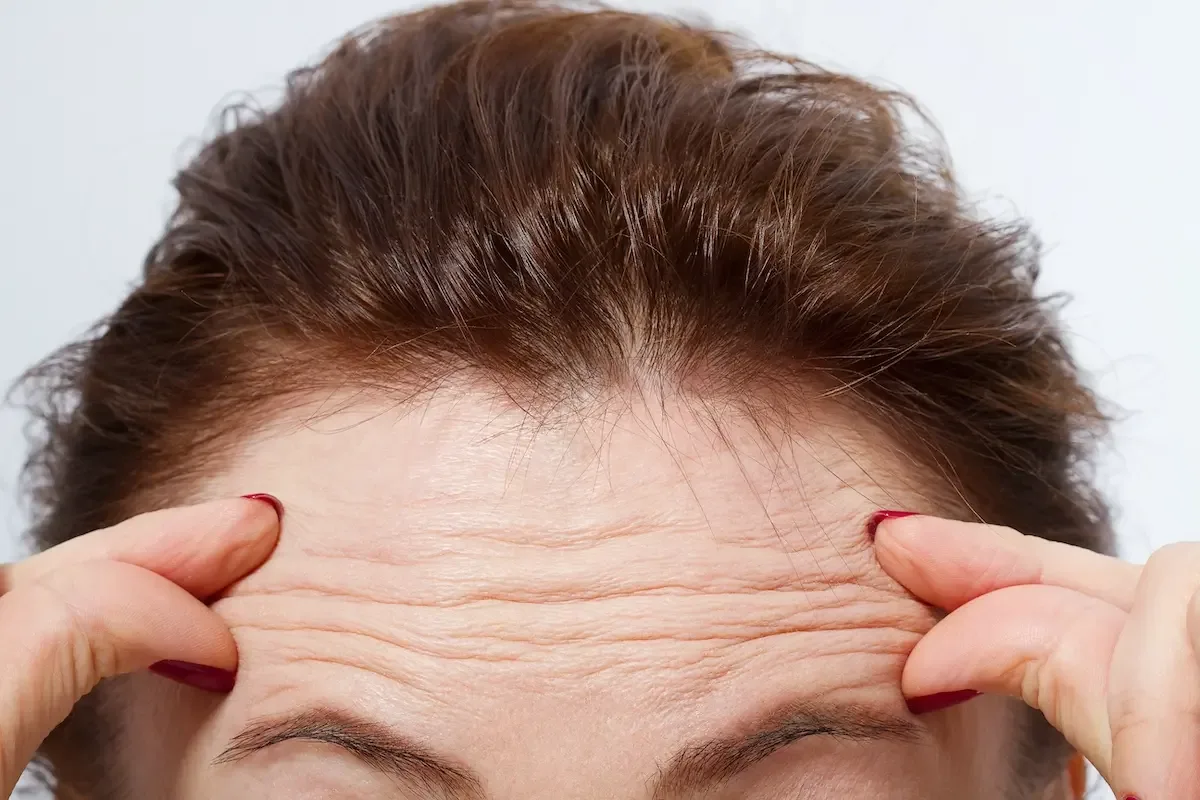 Fine Lines & Wrinkles Treatment Near Johar Town Lahore