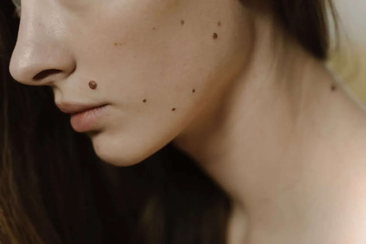 Pigmentation & Dark Spots Treatment Near Johar Town Lahore